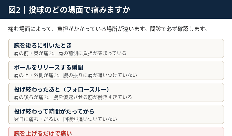 腕を引いたとき、リリース時、フォロースルーなど痛む場面ごとに負担のかかる場所を整理した図